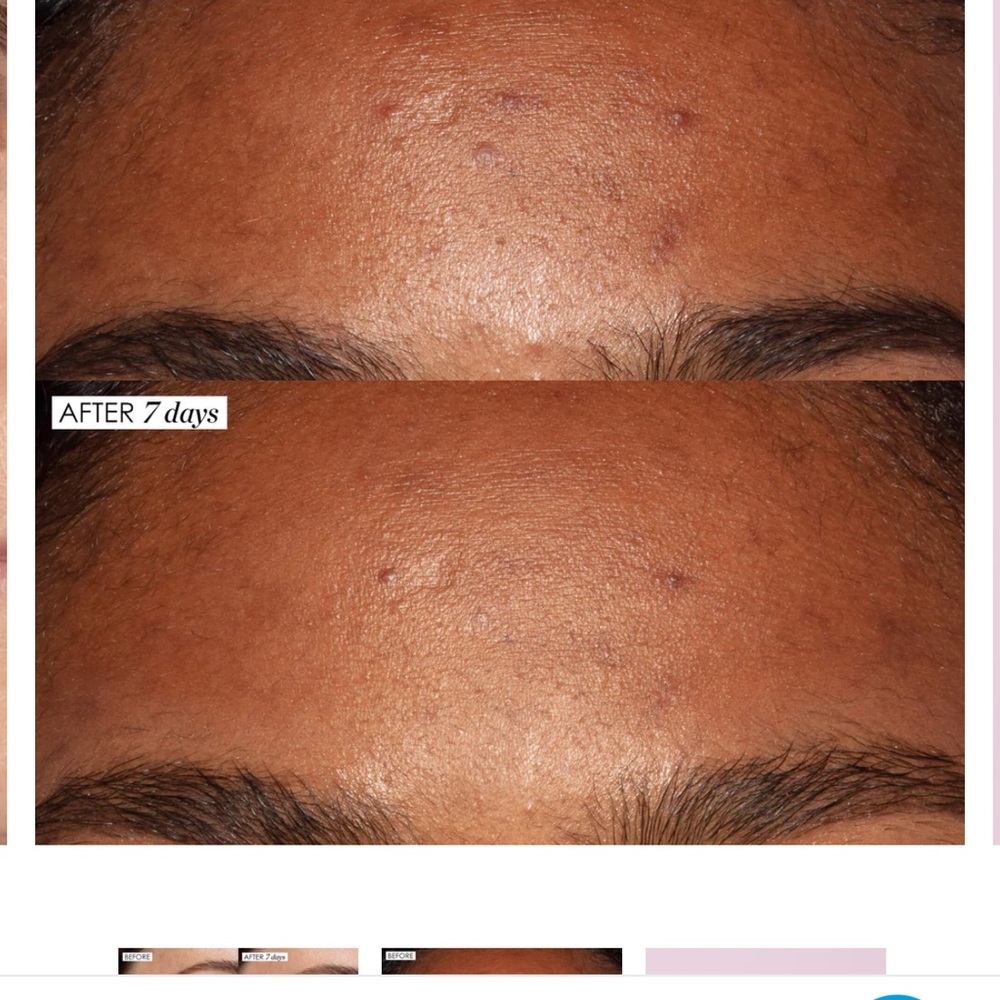 Sunday Riley ~ ‘ALL-IN-ONE LACTIC ACID TREATMENT’ ~ FS ~> 1.0 oz./30 ml ~ NWOB - Picture 7 of 15